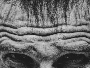 Close-up of an elderly person's forehead with wrinkles.
