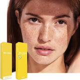 Belotero soft with Lidocaine